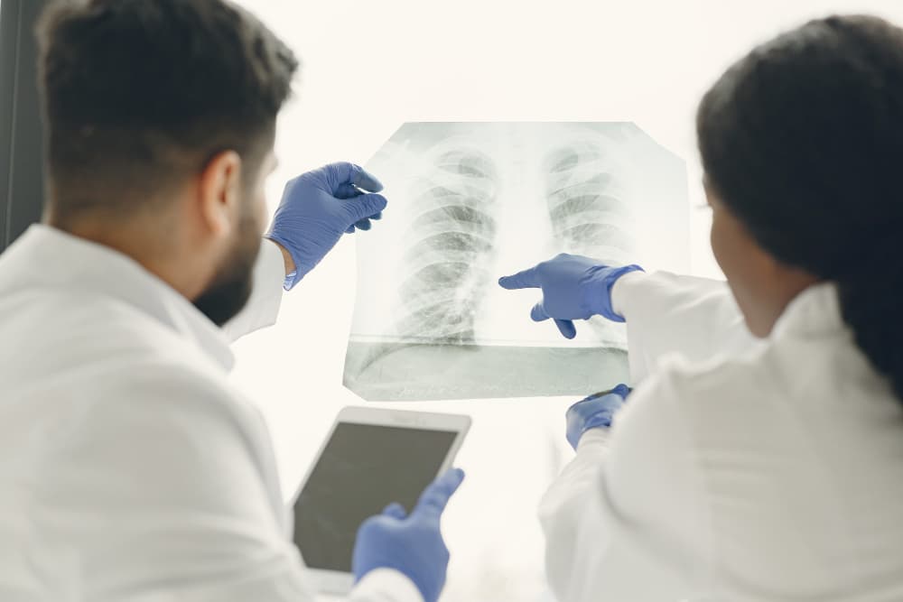 Deteksi Dini Belum Optimal Jadi Salah Satu Penyebab Tingginya Kasus Kanker Paru